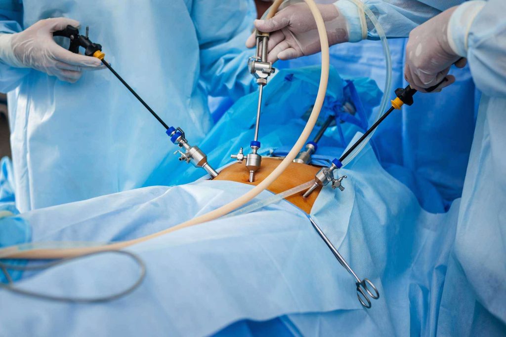 advanced endoscopic procedures